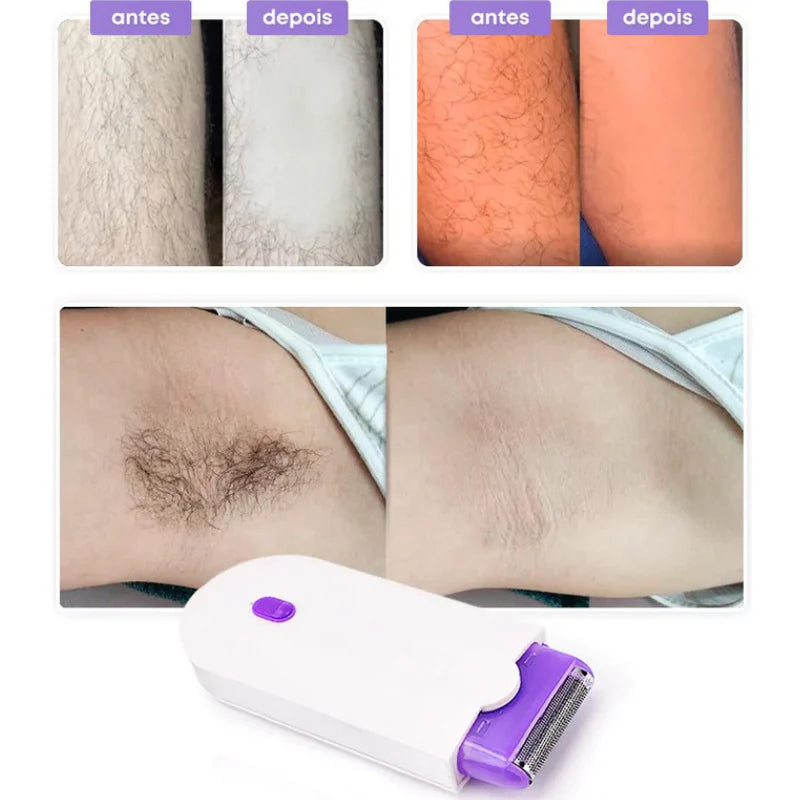 Depilador a Laser Indolor Profissional - ShaveLaser